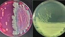 Crean un c&oacute;ctel de bacterias para restaurar suelos contaminados por pl&aacute;sticos